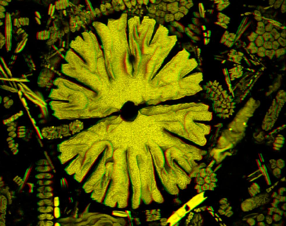 Diatom - Ahlam Alhusaini